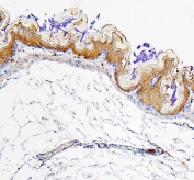 IHC staining of FFPE mouse stomach with ALDH1A1 antibody. HIER: boil tissue sections in pH6, 10mM citrate buffer, for 20 min and allow to cool before testing.