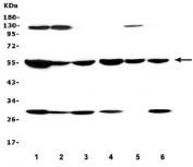 Western blot testing of 1) rat liver, 2) rat lung, 3) rat kidney, 4) mouse liver, 5) mouse lung and 6) mouse kidney lysate with ALDH1A1 antibody. Expected molecular weight ~55 kDa.