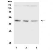 Western blot testing of human 1) HEK293, 2) HepG2 and 3) ThP-1 cell lysate with SDHB antibody. Predicted molecular weight ~32 kDa.