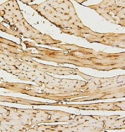 IHC staining of FFPE mouse heart with SDHB antibody. HIER: boil tissue sections in pH6, 10mM citrate buffer, for 20 min and allow to cool before testing.