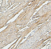 IHC staining of FFPE rat heart with SDHB antibody. HIER: boil tissue sections in pH6, 10mM citrate buffer, for 20 min and allow to cool before testing.