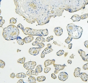 IHC staining of FFPE human placenta with PLK1 antibody. HIER: boil tissue sections in pH6, 10mM citrate buffer, for 20 min and allow to cool before testing.