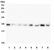 Western blot testing of 1) human HepG2, 2) human CCRF-CEM, 3) monkey COS-7, 4) human SW620, 5) human ThP-1, 6) rat PC-12, 7) rat RH35 and 8) mouse NIH3T3 with HMGB1 antibody. Predicted molecular weight ~25 kDa.