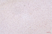IHC staining of FFPE rat brain with HMGB1 antibody. HIER: boil tissue sections in pH6, 10mM citrate buffer, for 20 min and allow to cool before testing.