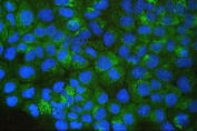 Immunofluorescent staining of FFPE human A431 cells with SQSTM1 antibody (green) and DAPI (blue). HIER: boil tissue sections in pH6, 10mM citrate buffer, for 20 min and allow to cool before testing.