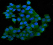 Immunofluorescent staining of FFPE human MCF7 cells with SQSTM1 antibody (green) and DAPI (blue). HIER: boil tissue sections in pH6, 10mM citrate buffer, for 20 min and allow to cool before testing.