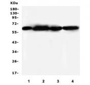 Western blot testing of human 1) CCRF-CEM, 2) HepG2, 3) HT1080, 4) SW620 lysate with SQSTM1 antibody. Routinely observed at ~62 kDa.