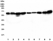 Western blot testing of 1) rat brain, 2) rat liver, 3) rat PC-12, 4) rat RH35, 5) mouse brain, 6) mouse liver, 7) mouse NIH3T3, 8) mouse RAW246.7 and 9) mouse Neuro-2a lysate with SQSTM1 antibody. Routinely observed at ~62 kDa.