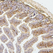 IHC staining of FFPE mouse intestine with SQSTM1 antibody. HIER: boil tissue sections in pH6, 10mM citrate buffer, for 20 min and allow to cool before testing.