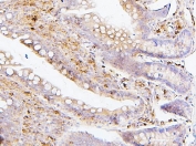 IHC staining of FFPE rat intestine with SQSTM1 antibody. HIER: boil tissue sections in pH6, 10mM citrate buffer, for 20 min and allow to cool before testing.