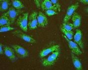 Immunofluorescent staining of FFPE human U-2 OS cells with EIF4G1 antibody (green) and DAPI (blue). HIER: boil tissue sections in pH6, 10mM citrate buffer, for 20 min and allow to cool before testing.