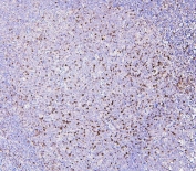 IHC staining of FFPE human tonsil with RAB27A antibody. HIER: boil tissue sections in pH6, 10mM citrate buffer, for 20 min and allow to cool before testing.