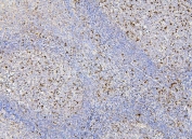 IHC staining of FFPE human tonsil with RAB27A antibody. HIER: boil tissue sections in pH6, 10mM citrate buffer, for 20 min and allow to cool before testing.