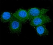 Immunofluorescent staining of FFPE human MCF7 cells with RAB27A antibody (green) and DAPI (blue).