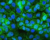 Immunofluorescent staining of FFPE human A431 cells with Hsp105 antibody (green) and DAPI (blue). HIER: boil tissue sections in pH6, 10mM citrate buffer, for 20 min and allow to cool before testing.