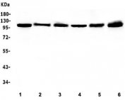 Western blot testing of human 1) Caco-2, 2) K562, 3) A549, 4) HepG2, 5) PANC-1 and 6) SGC-7901 cell lysate with Hsp105 antibody. Expected molecular weight: 105-110 kDa.