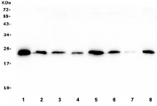 Western blot testing of human 1) HL60, 2) T-47D, 3) A549, 4) U-2 OS, 5) ThP-1, 6) HepG2, 7) PANC-1 and 8) SW620 lysate with Ran antibody. Predicted molecular weight ~24 kDa.