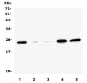 Western blot testing of 1) rat testis, 2) mouse lung, 3) mouse kidney, 4) mouse testis and 5) mouse Neuro-2a lysate with Ran antibody. Predicted molecular weight ~24 kDa.
