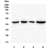 Western blot testing of 1) rat thymus, 2) mouse thymus, 3) mouse lung and 7) mouse SP20 lysate with EIF4A1/2/3 antibody. Predicted molecular weight ~46 kDa.