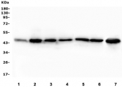 Western blot testing of human 1) placenta 2) HEK293, 3) A549, 4) HepG2, 5) U-87 MG, 6) PC-3 and 7) K562 lysate with EIF4A1/2/3 antibody. Predicted molecular weight ~46 kDa.