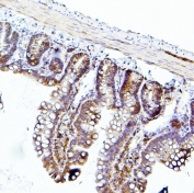 IHC staining of FFPE rat intestine with EIF4A1/2/3 antibody. HIER: boil tissue sections in pH6, 10mM citrate buffer, for 20 min and allow to cool before testing.