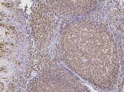 IHC staining of FFPE human tonsil with PAX5 antibody. HIER: boil tissue sections in pH6, 10mM citrate buffer, for 20 min and allow to cool before testing.