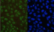 Immunofluorescent staining of FFPE human U-2 OS cells with PAX5 antibody (green) and DAPI (blue). HIER: boil tissue sections in pH6, 10mM citrate buffer, for 20 min and allow to cool before testing.