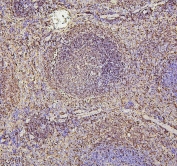 IHC staining of FFPE mouse spleen with PAX5 antibody. HIER: boil tissue sections in pH6, 10mM citrate buffer, for 20 min and allow to cool before testing.
