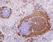 IHC staining of FFPE rat spleen with PAX5 antibody. HIER: boil tissue sections in pH6, 10mM citrate buffer, for 20 min and allow to cool before testing.