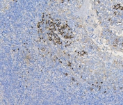 IHC staining of FFPE human tonsil with COPE antibody. HIER: boil tissue sections in pH6, 10mM citrate buffer, for 20 min and allow to cool before testing.