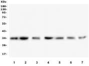Western blot testing of human 1) HEK293, 2) HepG2, 3) placenta, 4) Caco-2, 5) A549, 6) PANC-1 and 7) SW579 lysate with COPE antibody. Predicted molecular weight ~34 kDa.
