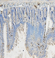 IHC staining of FFPE rat intestine with COPE antibody. HIER: boil tissue sections in pH6, 10mM citrate buffer, for 20 min and allow to cool before testing.