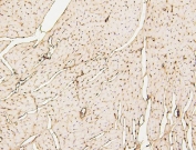 IHC staining of FFPE mouse heart with SDHB antibody. HIER: boil tissue sections in pH6, 10mM citrate buffer, for 20 min and allow to cool before testing.