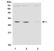 Western blot testing of human 1) HEK293, 2) HepG2 and 3) ThP-1 cell lysate with SDHB antibody. Predicted molecular weight ~32 kDa.