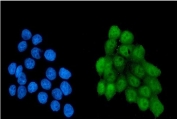 Immunofluorescent staining of human MCF7 cells with NRF1 antibody (green) DAPI nuclear stain (blue). HIER: boil tissue sections in pH6, 10mM citrate buffer, for 20 min and allow to cool before testing.