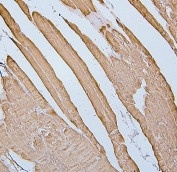 IHC staining of FFPE human skeletal muscle with Desmin antibody. HIER: boil tissue sections in pH6, 10mM citrate buffer, for 20 min and allow to cool before testing.