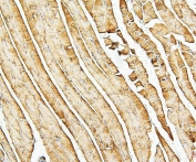 IHC staining of FFPE rat skeletal muscle with Desmin antibody. HIER: boil tissue sections in pH6, 10mM citrate buffer, for 20 min and allow to cool before testing.