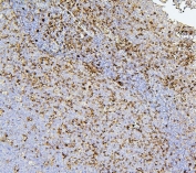 IHC staining of FFPE human tonsil with CD43 antibody. HIER: boil tissue sections in pH6, 10mM citrate buffer, for 20 min and allow to cool before testing.