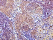 IHC staining of FFPE rat spleen with CD43 antibody. HIER: boil tissue sections in pH6, 10mM citrate buffer, for 20 min and allow to cool before testing.