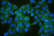 Immunofluorescent staining of FFPE human A431 cells with COMT antibody (green) and DAPI (blue). HIER: boil tissue sections in pH6, 10mM citrate buffer, for 20 min and allow to cool before testing.