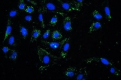 Immunofluorescent staining of FFPE human U-2 OS cells with PRKCD antibody. HIER: boil tissue sections in pH6, 10mM citrate buffer, for 20 min and allow to cool before testing.