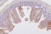 IHC staining of FFPE rat intestine with PRKCD antibody. HIER: boil tissue sections in pH6, 10mM citrate buffer, for 20 min and allow to cool before testing.