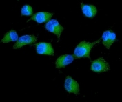 Immunofluorescent staining of FFPE human A549 cells with PRKCD antibody. HIER: boil tissue sections in pH6, 10mM citrate buffer, for 20 min and allow to cool before testing.