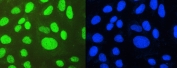 Immunofluorescent staining of FFPE U-2 OS cells with PTBP1 antibody (green) and DAPI (blue). HIER: boil tissue sections in pH6, 10mM citrate buffer, for 20 min and allow to cool before testing.