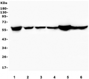 Western blot testing of 1) rat testis, 2) mouse thymus, 3) mouse lung, 4) mouse kidney, 5) mouse testis and 6) mouse SP20 lysate with PTBP1 antibody. Predicted molecular weight ~57 kDa.