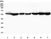 Western blot testing of human 1) placenta, 2) K562, 3) A431, 4) A549, 5) Caco-2, 6) HEK293 and 7) U-2 OS lysate with PTBP1 antibody. Predicted molecular weight ~57 kDa.