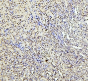 IHC staining of FFPE mouse kidney with PTBP1 antibody. HIER: boil tissue sections in pH6, 10mM citrate buffer, for 20 min and allow to cool before testing.