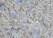 IHC staining of FFPE rat kidney with PTBP1 antibody. HIER: boil tissue sections in pH6, 10mM citrate buffer, for 20 min and allow to cool before testing.