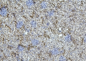 IHC staining of FFPE rat kidney with PTBP1 antibody. HIER: boil tissue sections in pH6, 10mM citrate buffer, for 20 min and allow to cool before testing.