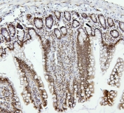 IHC staining of FFPE rat intestine with PTBP1 antibody. HIER: boil tissue sections in pH6, 10mM citrate buffer, for 20 min and allow to cool before testing.